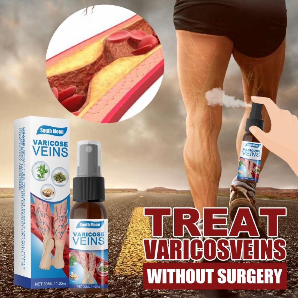 Vein Treatment Varicose Vein Treatment Spray YT