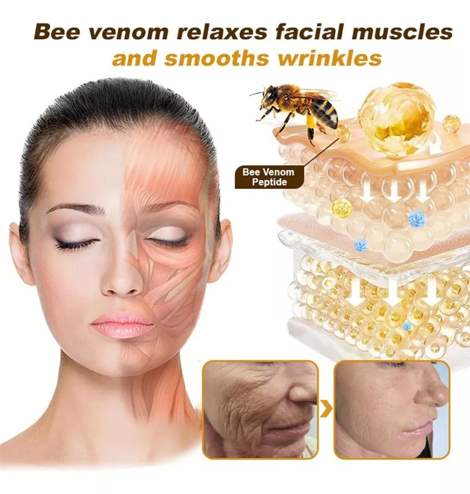 Botox Bee Venom