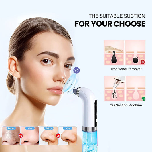 Electric Bubble Blackhead Remover