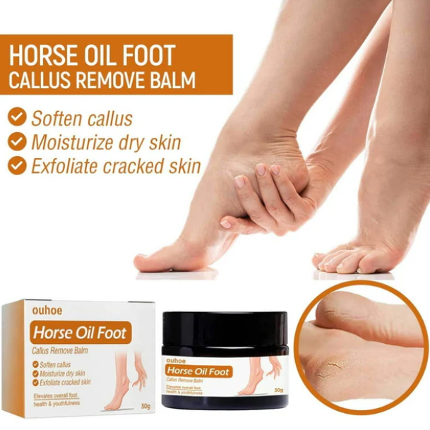 Horse Oil Foot Callus Remedy Balm