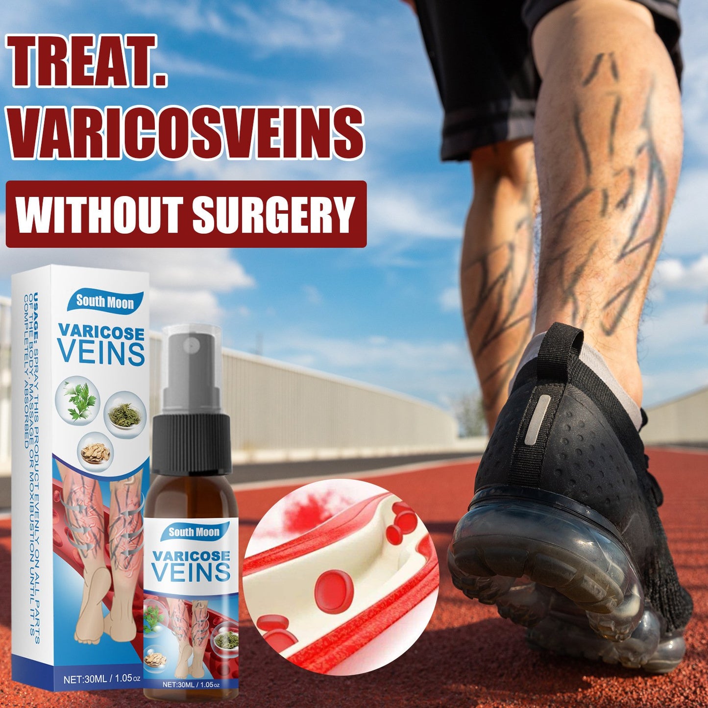 Vein Treatment Varicose Vein Treatment Spray YT